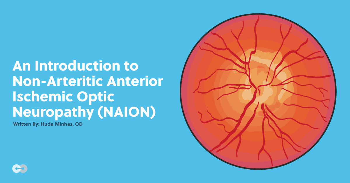 An Introduction to Non-Arteritic Anterior Ischemic Optic Neuropathy (NAION)